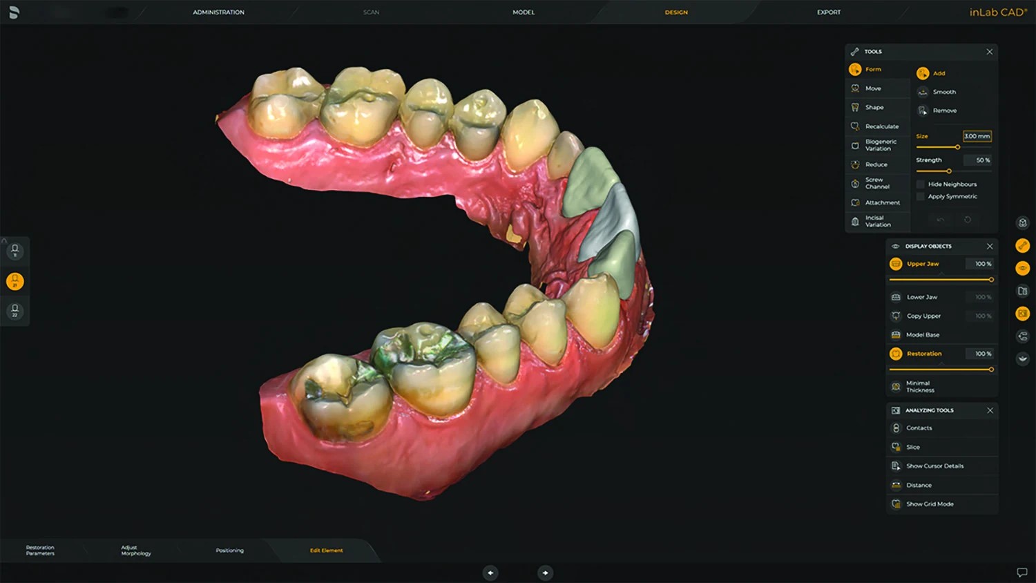 Virtual custom porcelain restoration design