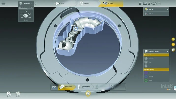 Computer-guided implant planning workflow